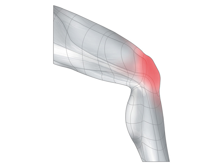 sensiplast® Kniegelenkbandage, mit Anti-Rutsch-Beschichtung